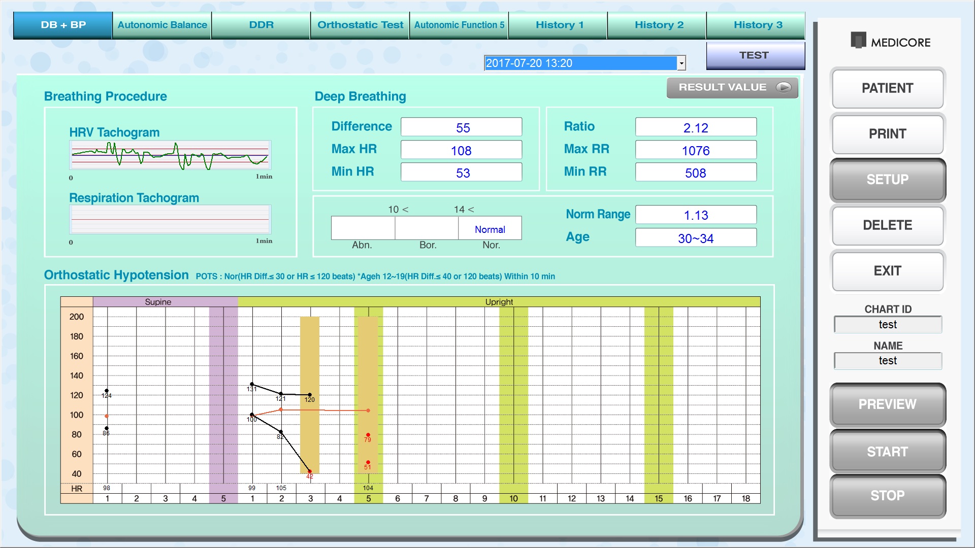 AFT-800 RESULT - DB+BP